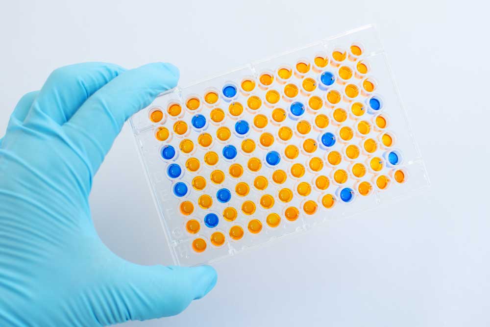 Detecting gluten in food accurately AOECS